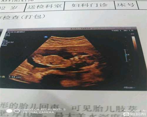 上海供卵中介机构_上海供卵公立医院成功率_试管婴儿移植一个胚胎也会双胎吗