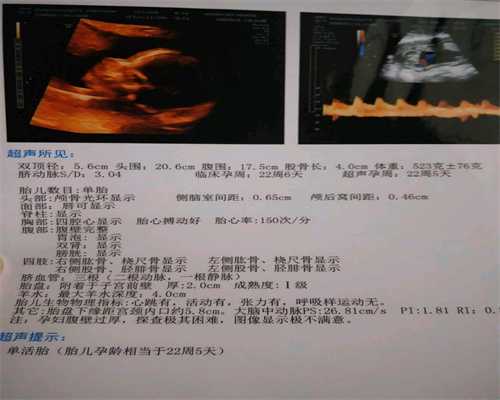 上海代怀多少钱_上海等供卵要多长时间_试管婴儿移植后有腹痛吗？试管婴儿在