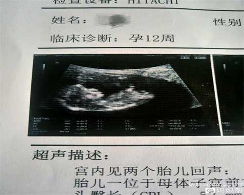 上海子宫腺肌症供卵的成功率_上海供卵试管婴儿医院排名_[试管婴儿]我的六年