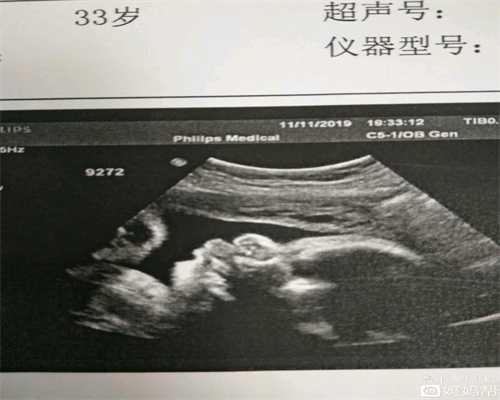 上海卵巢早衰做供卵试管_供精供卵是什么意思_试管婴儿促排卵会形成卵巢早衰