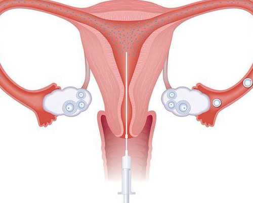 女版勃锐精效果好不好？服用勃锐精效果超好