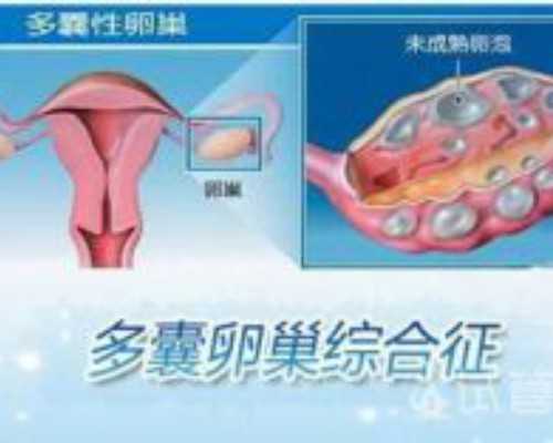 高龄女性做第三代试管，如何提高卵子质量？