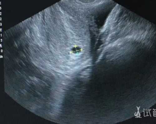 备孕排卵后7天能同房吗